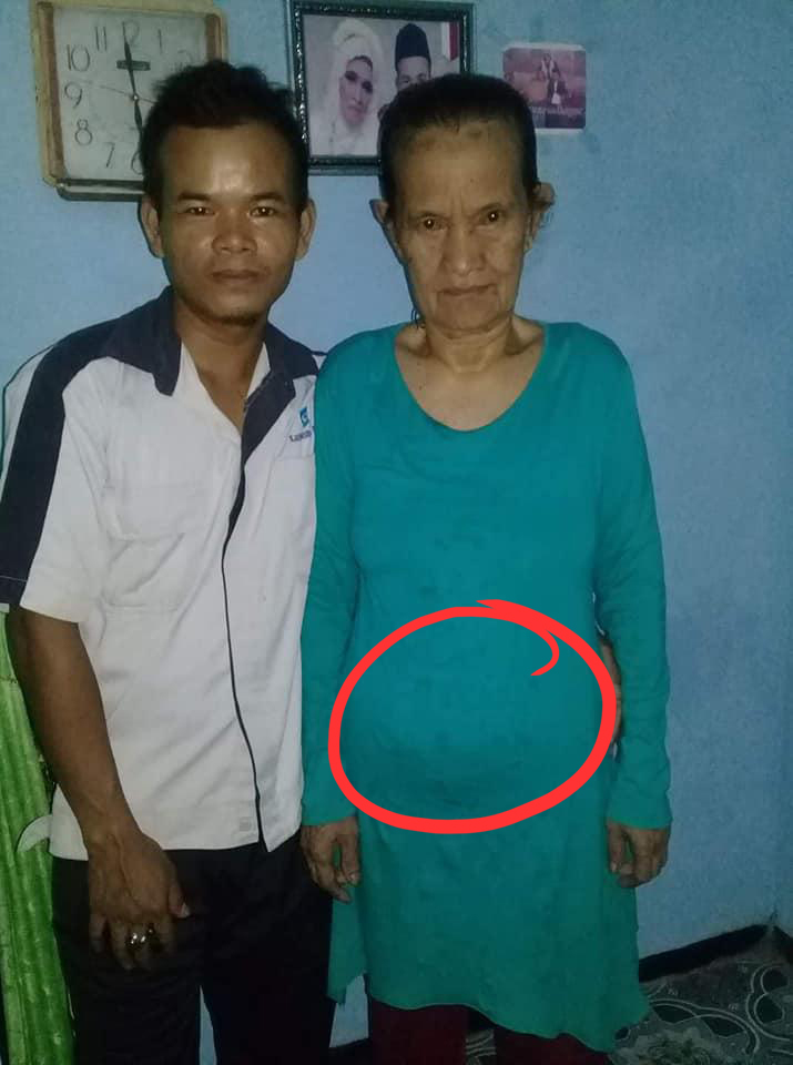 Thực hư cụ bà 78 tuổi có thai sau khi cưới chồng 28 tuổi