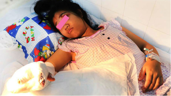 Container cán nát tay phải của thiếu nữ ước mơ thành nhà thiết kế