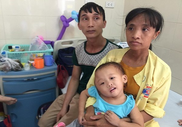 Bé gái 2 tuổi bị biến dạng khuôn mặt vì u màng nhện