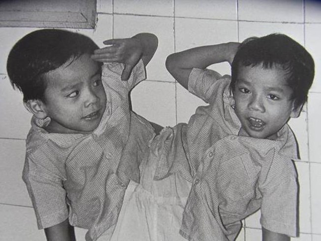 Cặp song sinh Việt-Đức là những gương mặt đầy tình cảm và đầy triển vọng. Bức ảnh của họ chắc chắn sẽ khiến bạn thích thú với sự đôi lứa này. Hãy xem và cảm nhận những nụ cười và niềm vui mà cặp song sinh đem lại.