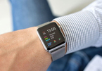 Chọn đồng hồ thông minh của Apple, Samsung hay LG?