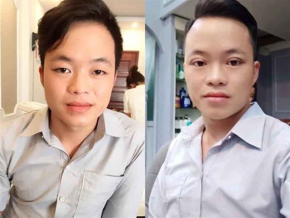 Cô dâu 62 tuổi đi làm tóc với khuôn mặt sưng phồng sau phẫu thuật