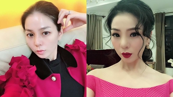 Lệ Quyên phải tháo sụn mũi giả vì hoại tử, ảnh hưởng đến tính mạng