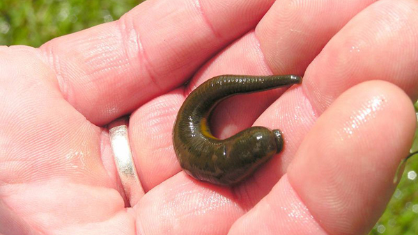 Gắp con đỉa dài 5cm từ cổ họng bé gái 9 tuổi ở Nghệ An