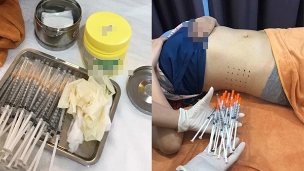 Sự thật đằng sau những ống tiêm tinh chất giảm cân đắt đỏ