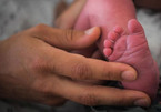 Bí ẩn chuyện hàng loạt trẻ sơ sinh chào đời không có tay
