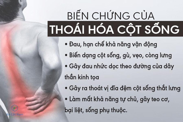 4. Phương Pháp Điều Trị Thoái Hóa Cột Sống