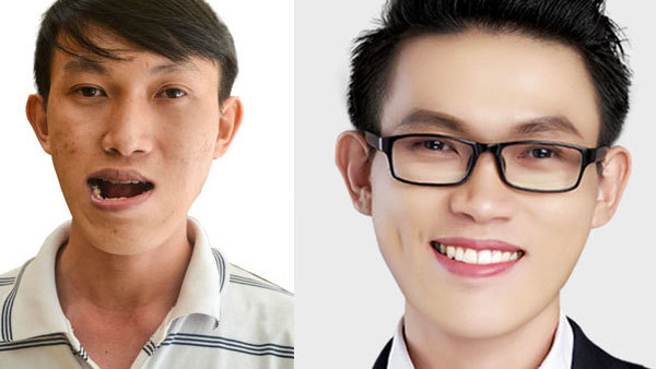 Màn lột xác không tưởng của chàng thạc sĩ mặt ‘lưỡi cày’