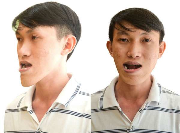 Màn lột xác không tưởng của chàng thạc sĩ mặt 'lưỡi cày'