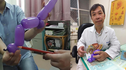 Tư thế yêu táo bạo khiến người đàn ông 62 tuổi gãy súng làm 3 Tư thế yêu táo bạo khiến người đàn ông 62 tuổi gãy súng làm 3