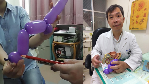 Tư thế yêu táo bạo khiến người đàn ông 62 tuổi gãy súng làm 3