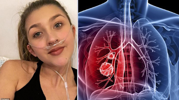 Mắc căn bệnh người già, cô gái 19 tuổi ghép tạng 3 lần để được sống