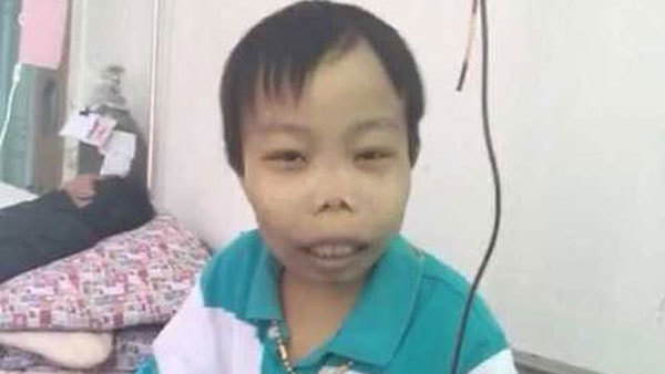 'Thiếu gia xấu xí' từng khiến dân mạng náo loạn giờ ra sao?