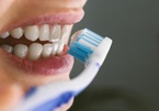 90% người Việt mắc bệnh răng miệng chỉ vì 10 thói quen khó bỏ này