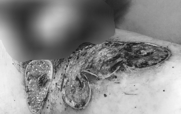 ‘Cậu nhỏ’ nam thanh niên bốc mùi hôi thối vì chủ quan