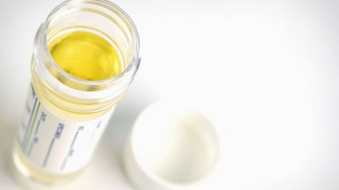 Kính hiển vi lực nguyên tử phát hiện ung thư chính xác đến 94%