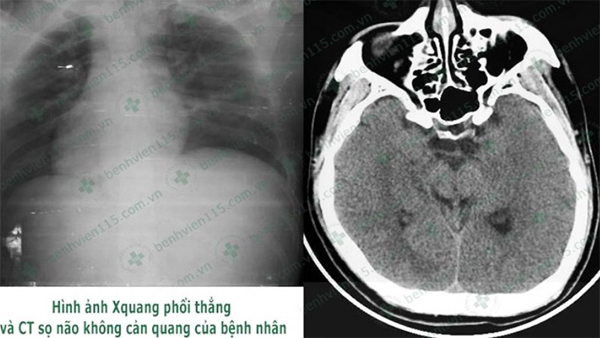 Nhịn ăn sáng, tài xế bị hạ đường huyết hôn mê sâu ngay trên đường