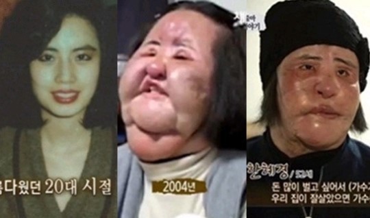 Mỹ nữ Hàn Quốc nghiện thẩm mỹ chết trong cô độc ở tuổi 57