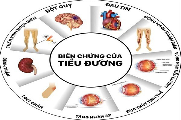 NSND Anh Tú qua đời, bệnh tiểu đường,NSND Anh Tú