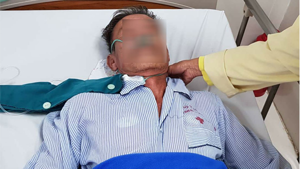 Cứu sống bệnh nhân ngừng tim do ngộ độc cá nóc