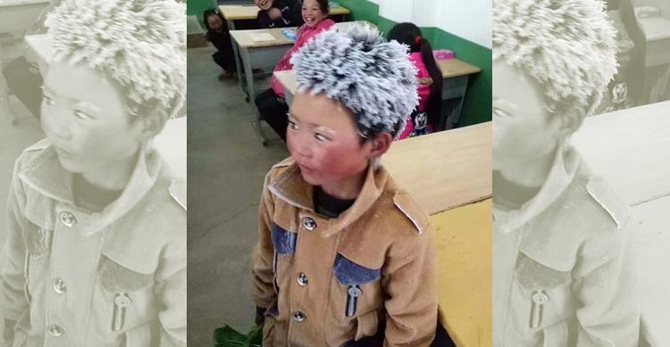 Cậu bé tóc đóng băng đổi đời sau một năm nhờ bức ảnh 