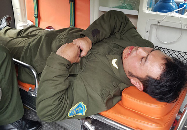 Nhân viên an ninh sân bay Nội Bài bị đánh gãy 4 răng