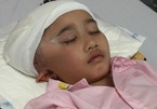 Phẫu thuật u não 4 lần, bé gái 10 tuổi đối diện hiểm nguy