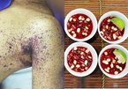 Ăn tiết canh giải đen cuối năm, 1 quý ông mất mạng