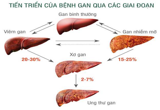 Lý Triệu Cơ, ung thư gan, Triệu chứng mắc ung thư