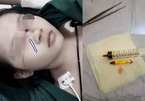 Tai nạn cận Tết: Bút chì cắm vào mắt, bé gái thoát chết trong gang tấc