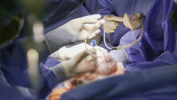 Hai bệnh viện thực hiện ca mổ 'thần tốc' cứu thai nhi bị bướu chèn đường thở