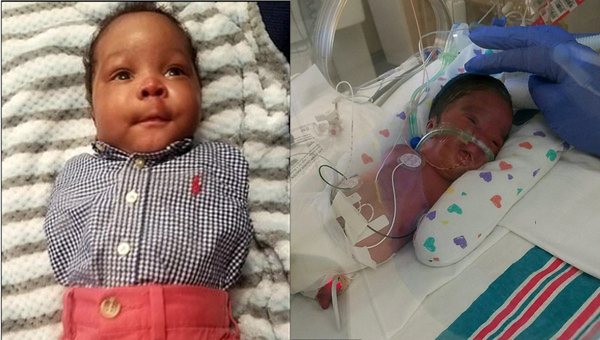 Cậu bé 'sọ dừa' không chân, không tay sống sót kỳ diệu