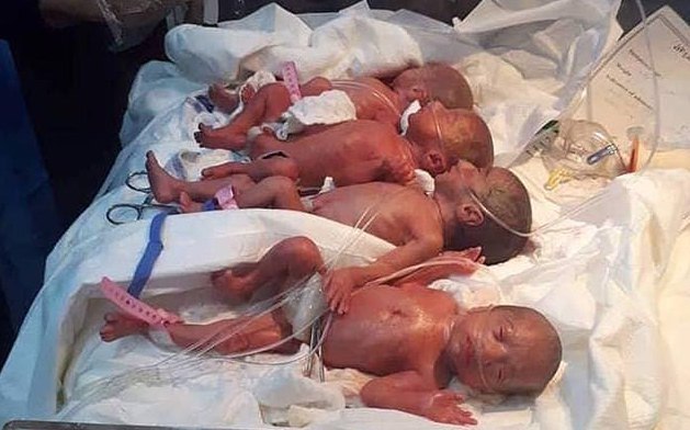 Bà mẹ trẻ sinh tự nhiên một lần 7 bé