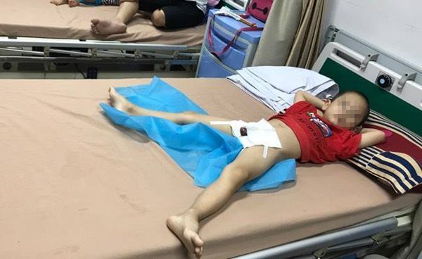 Thêm 29 bé trai Hưng Yên bị sùi mào gà do nong bao quy đầu tại nhà nữ y sĩ
