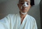 Lương Bằng Quang công khai phẫu thuật thẩm mỹ gương mặt sau 1 ngày
