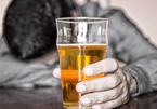 Cơ thể sẽ ra sao nếu bạn ngừng uống rượu bia trong 28 ngày?
