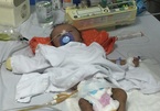 Bụng phình to do bệnh bẩm sinh, bé trai 3 tháng tuổi cầu cứu