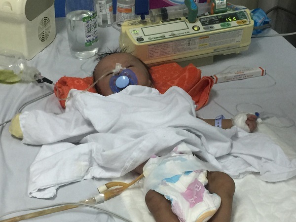 Bụng phình to do bệnh bẩm sinh, bé trai 3 tháng tuổi cầu cứu