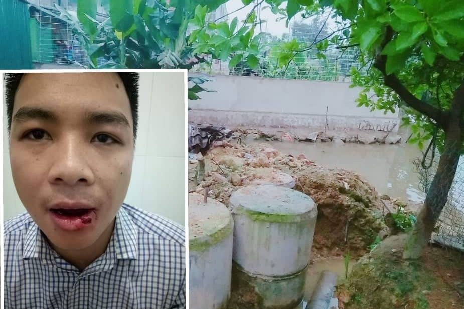 Thầy giáo Hà Tĩnh dùng tuýp sắt ném hàng xóm gãy 5 răng