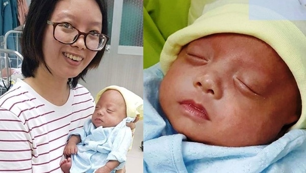 Em bé 'Kangaroo' khi sinh ra chỉ to bằng bàn tay được nuôi sống