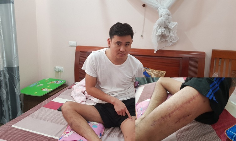 Cảnh sát 113 Thanh Hóa bắn thanh niên nát xương đùi vì nghi ngáo đá