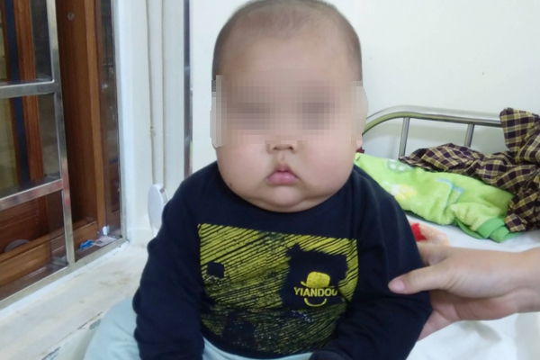 Tưởng con béo mập, bé 17 tháng ở Tuyên Quang phải nhập viện gấp