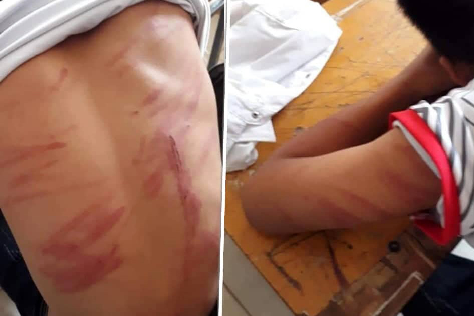 Điều tra vụ học sinh lớp 8 ở Hà Tĩnh bị bố đánh đập dã man