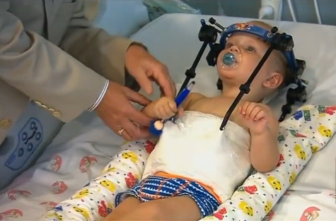 Bé trai 16 tháng tuổi sống sót thần kỳ sau tai nạn 'lìa đầu'