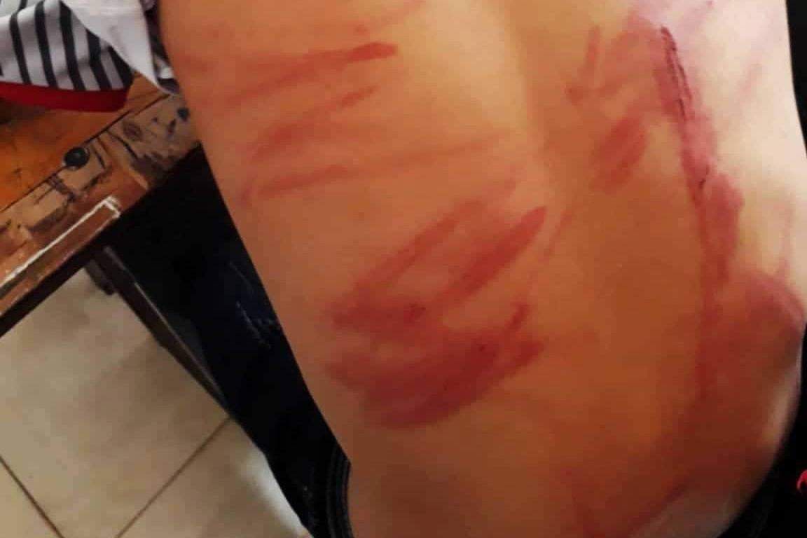 Ông bố Hà Tĩnh đánh con học lớp 8 dã man vì nỗi nghi ngờ nhỏ