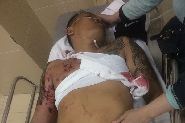 Nhóm người bịt mặt nổ súng bắn nam thanh niên tại quán cà phê