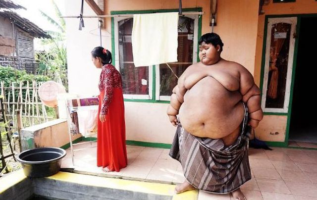 Cuộc sống của cậu bé từng được mệnh danh 'nặng nhất thế giới' giờ ra sao?