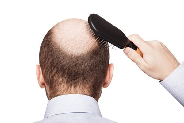 Dầu gội trị rụng tóc cho nam 17 loại dầu gội ngăn rụng tóc tốt