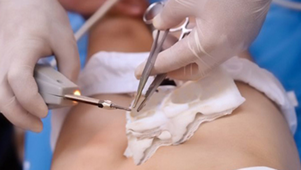 Thanh niên gặp sự cố với của quý khi đòi chia tay bạn gái