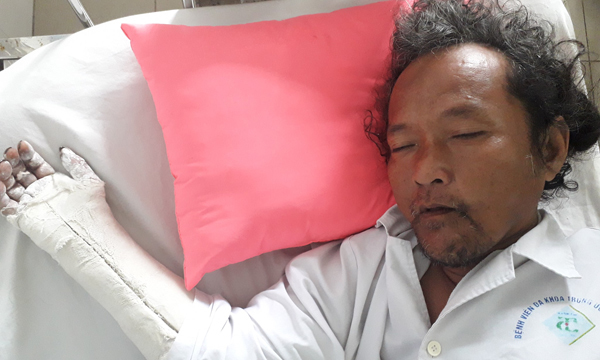 Tìm thân nhân cho người đàn ông bị chấn thương sọ não